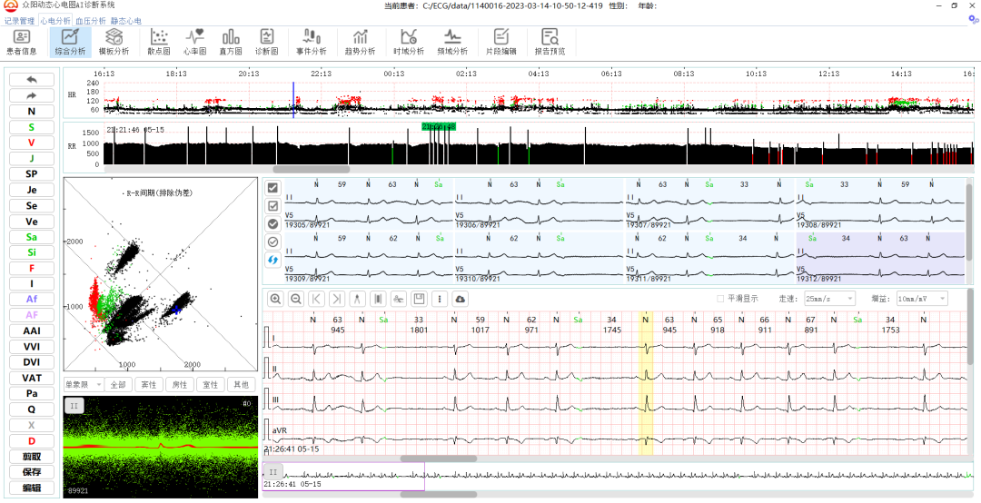 房早未下传全自动鉴别分析